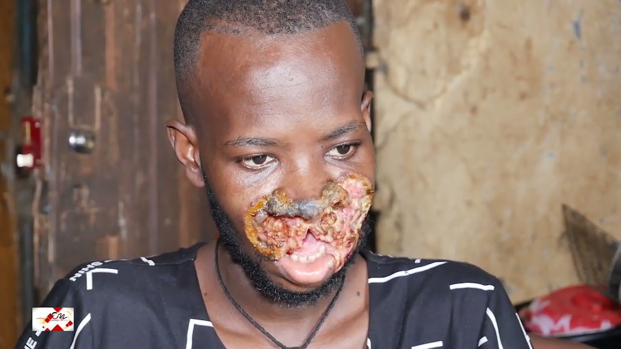 Conakry Nouvelles SOS POUR MALICK MANE