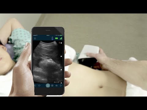 BC Doctor Relies on Portable Ultrasound to Triage Patients on the mountain BC Doctor Relies on Portable Ultrasound to Triage Patients on the mountain