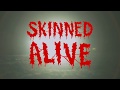 Skinned Alive