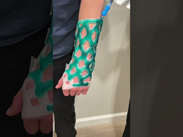 Un soporte para lesiones más ligero que el yeso😲