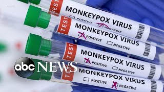 Monkeypox cases confirmed in 29 non-endemic countries: CDC