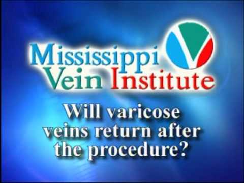 Treatments for Varicose & Spider Vein by Mississippi Vein Institute