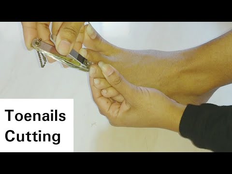 Toenails Cutting Of Long Nails | Toenails Cutting | Stayprettysangita