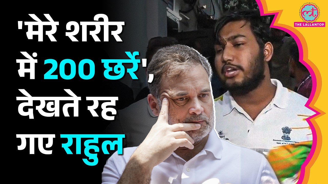 Pellet Gun मामले में FIR के बाद Rahul Gandhi के साथ बाहर निकले पीड़ित Sahil ने अपना दर्द बताया