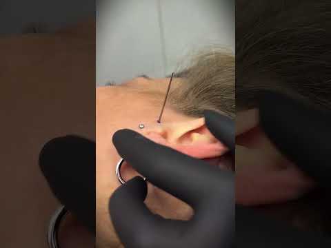 Check this out! ✨surface tragus piercing process