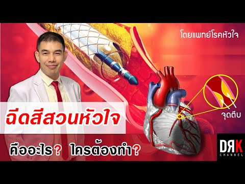 ฉีดสีสวนหัวใจ ❤️ คืออะไร ใครต้องทำ (Coronary Angio gram) - Doct