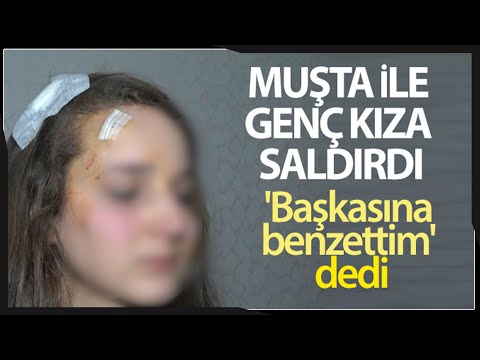 Genç Kız, Tanımadığı Kişi Tarafından Sokak Ortasında ‘Muşta’ İle Darp Edild