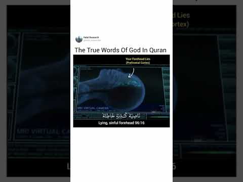 Quran mentions about the Forelock of the brain