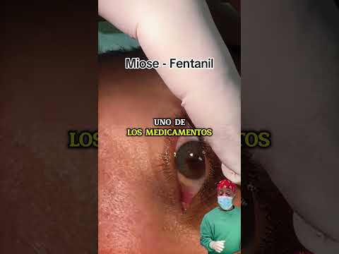 Cuando la pupila se cierra demasiado  #SHORTS