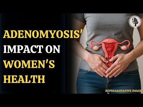 Adenomyosis: The Underdiagnosed Uterine Condition Affecting Millions | WION Podcast