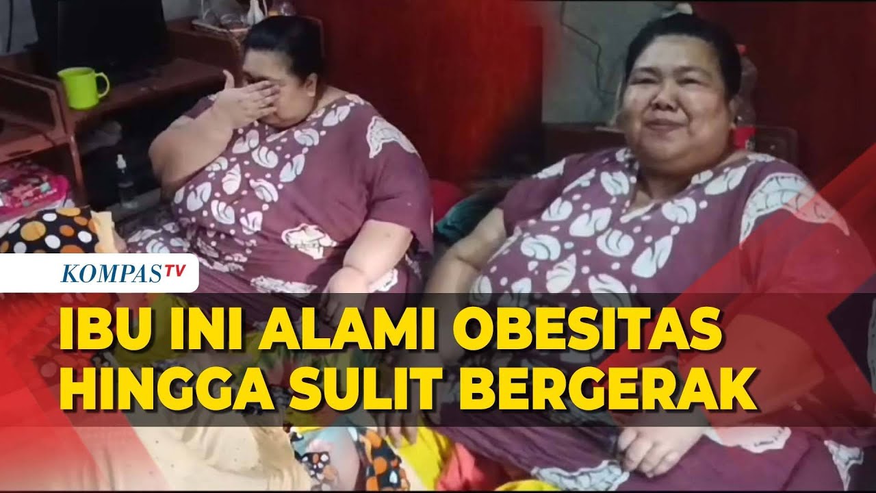 Seorang Ibu di Parepare Alami Obesitas, Berat Badan Capai 200 Kg