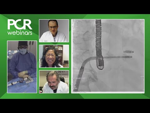 How should we use Transcatheter Tricuspid Valve Repair for patients with Tricuspid Regurgitation?