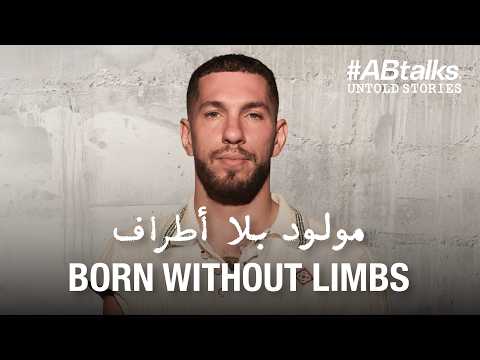 Born Without Limbs • مولود بلا أطراف | #ABtalks Untold Stories with Nick Santonastasso | Story 19