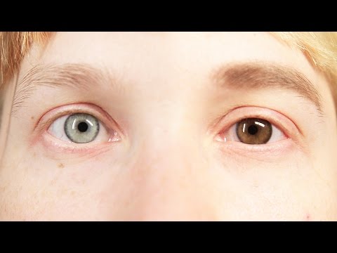 People Change Their Eye Color For A Week