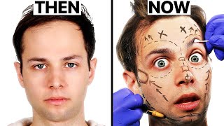 Surgeon Reacts to Should The Try Guys Do Plastic Surgery?