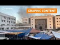 WARNING: GRAPHIC CONTENT: Israels war on Hamas homes in on Gaza hospitals