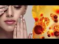 मेकअप ले सकता है जान! Cosmetics causing cancer | Onchologist | Health | Trending | Viral Videos |  - 26:11 min - News - Video