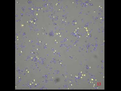 Cells monitored for 48h using fluorescent microscopy. AGS cells were treated with Extract of CNBX-RCK cannabis plant 802-2. Cells were stained with nuclear dye (blue) and cell death (yellow).