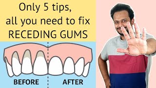 5 Habits to Naturally Heal Sensitive Teeth, Reverse Receding Gums, Gingivitis & Cavities