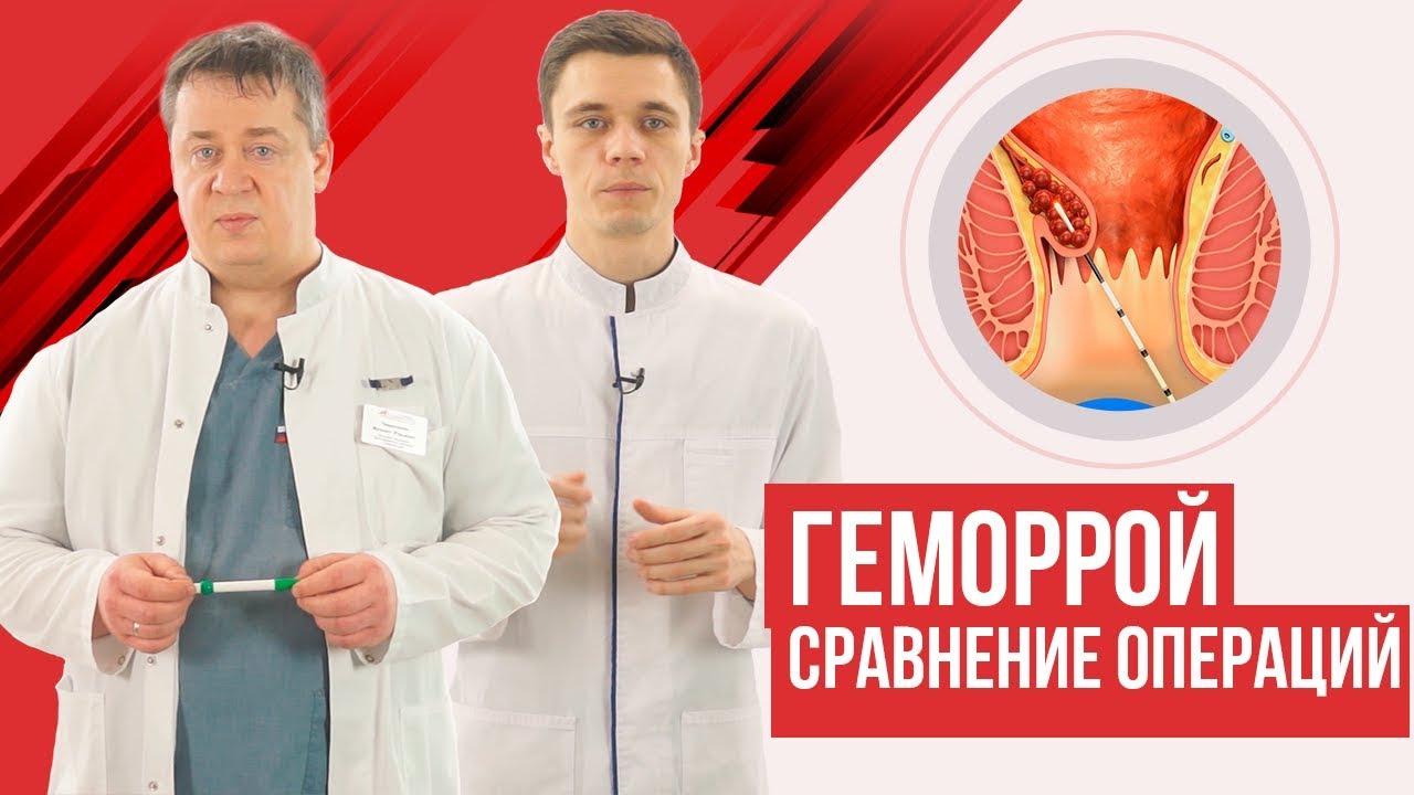 Геморрой лечение хирургия. Операция геморроя лазером. Лазерная коагуляция геморроя. Иссечение геморроидальных узлов лазером. Операция хал рар при геморрое.