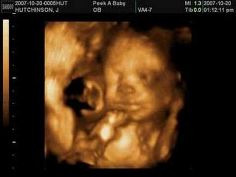 Cali's 4D Ultrasound 26 Weeks Pt.1 - YouTube