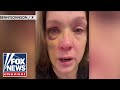 Cincinnati beating victim speaks out after brutal attack