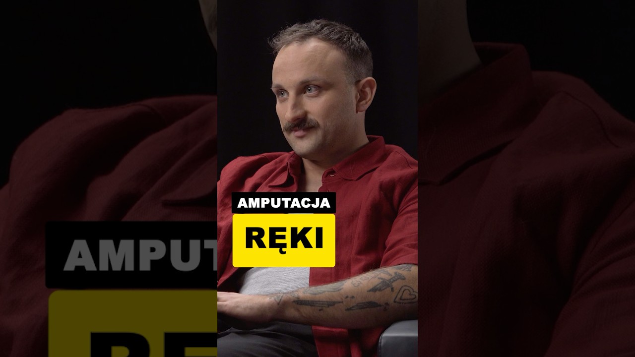 Amputacja ręki