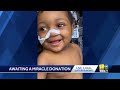 Family seeks liver transplant donors to save 9-month-old baby(WBAL) - 02:09 min - News - Video