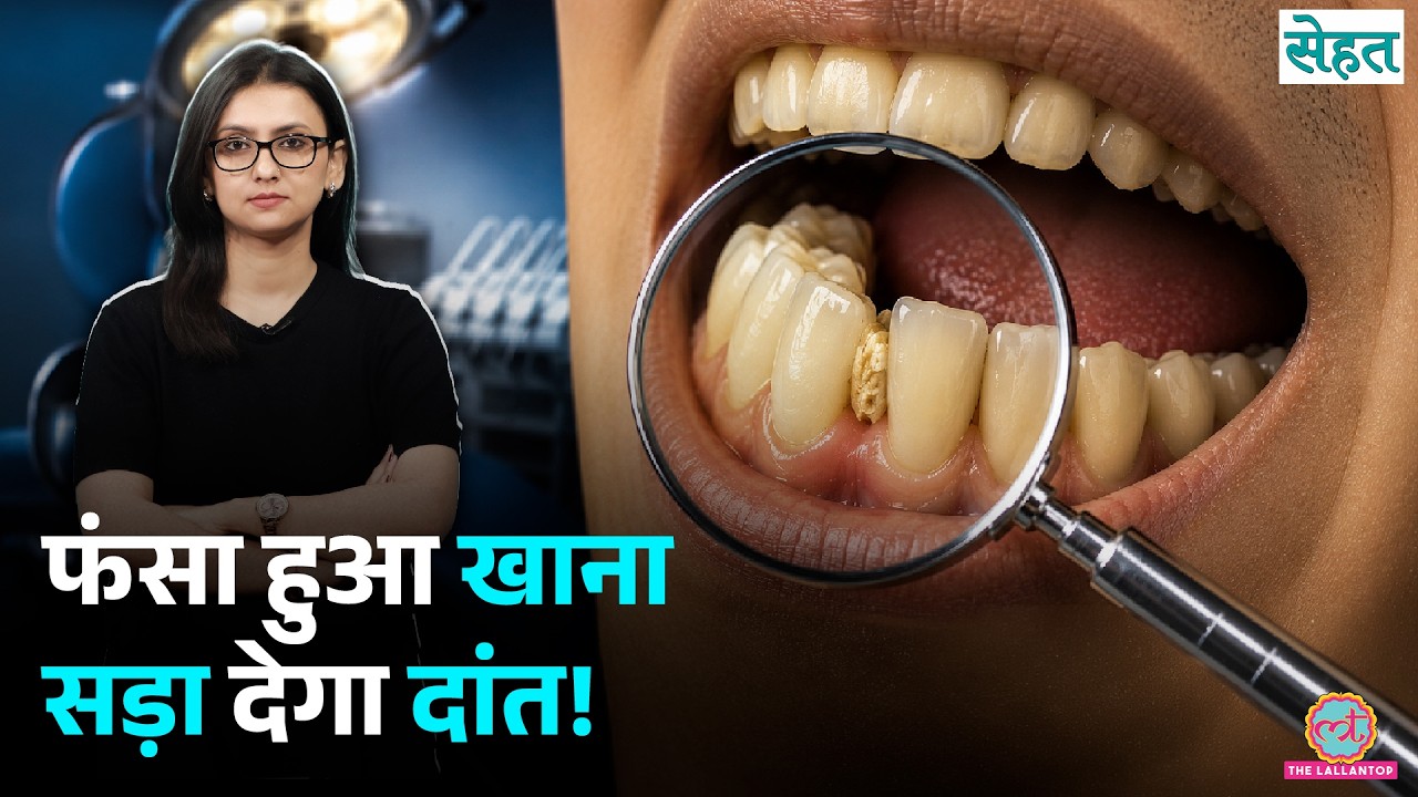 दांतों में खाना फंसा तो...ये गलती बिल्कुल न करें| Food Stuck In Teeth | Sehat Ep 1446