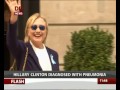 Hilary Clinton diagnosed with Pneumonia
