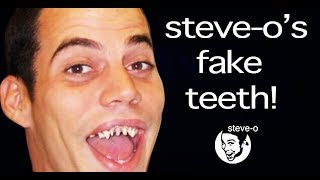The Untold Story of Steve Os Fake Teeth | Steve-O
