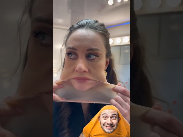 فتح راسه 😂