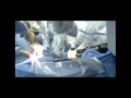 daVinci HD 3D Surgical Robot daVinci HD 3D Surgical Robot