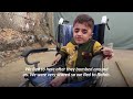 Displacement worsens health of brittle boned Gaza teen  - 01:47 min - News - Video