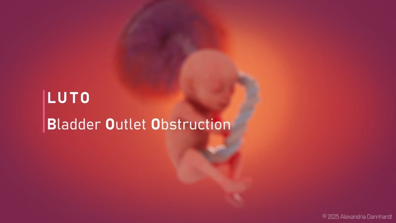 Lower Urinary Tract Obstruction | Johns Hopkins Center for Fetal Therapy