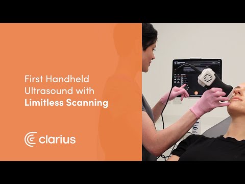 Once considered an impossible task for handheld ultrasound scanners, Clarius has cracked the code for continuous scanning with its new Clarius Power Fan HD3, which provides unlimited power and cooling with Clarius HD3 scanners. Watch the video to see the Clarius Power fan in action.