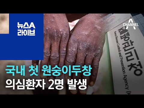 국내 첫 원숭이두창 의심환자 2명 발생…격리 치료 | 뉴스A 라이브
