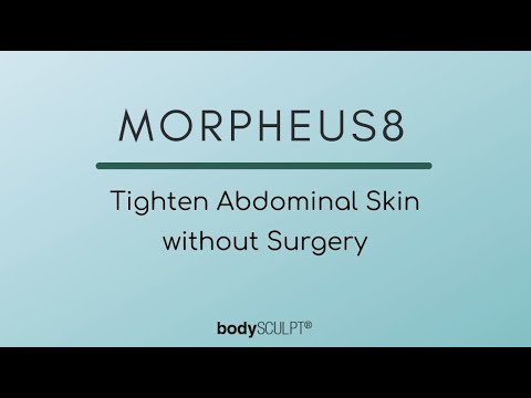 MORPHEUS8 to Tighten Abdominal Skin without Surgery
