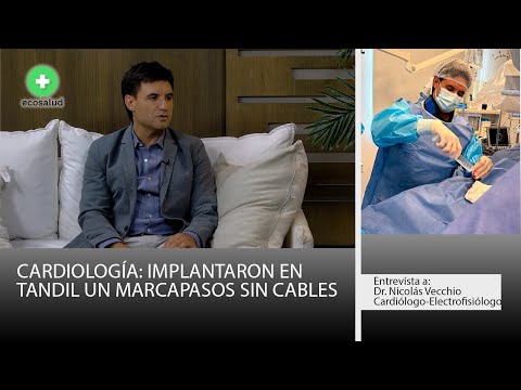 Implantaron en Tandil un marcapasos sin cables: cirugía inédita que marca un avance para la región
