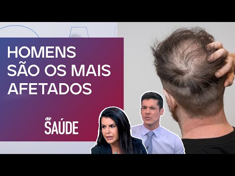 Quais principais causas da calvície genética? Especialistas analisam | JP SAÚDE