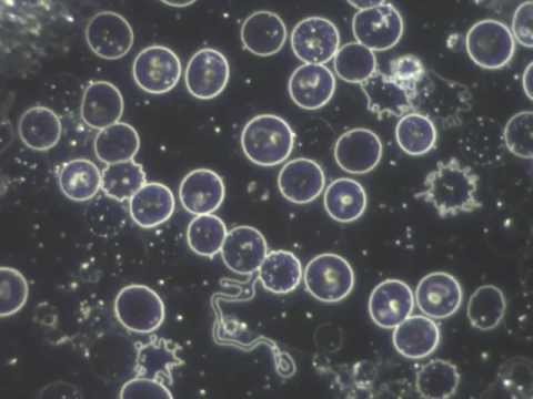 Sangre en vivo con microscopio de campo oscuro. Bacterias y parásitos