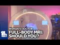 Full-body MRIs gaining in popularity, should you get one?