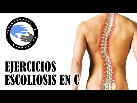 En la parte derecha inferior de la espalda el dolor agudo