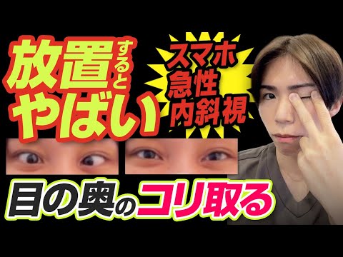 【スマホ急性内斜視】重たい目の奥をほぐして老眼、自律神経の乱れ、肩こり、首こり、ストレートネック解消ができる眼球整えマッサージ・外眼筋トレーニング、外眼筋マッサージ