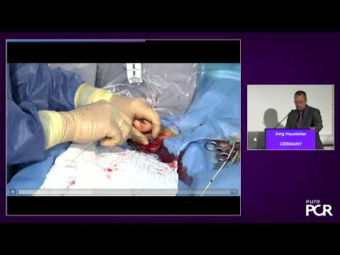 TricValve - Addressing the unmet need for patients with right heart failure and ... - EuroPCR2022