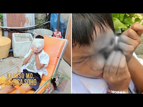 Grade 2 pupil sa Cebu City, aksidenteng natusok ng bakal ang kaliwang mata | Kapuso Mo, Jessica Soho