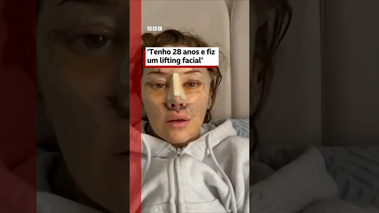 Por que tantos jovens estão recorrendo à cirurgia plástica 🔪💉