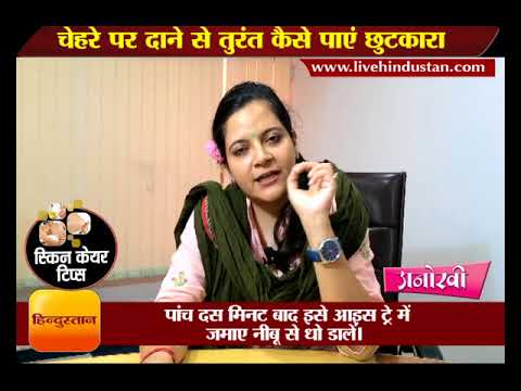 चेहरे पर दाने से तुरंत कैसे पाएं छुटकारा II Quick remedy to get rid of pimples or acne