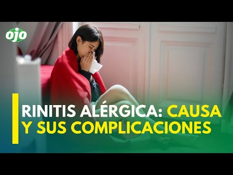 RINITIS ALÉRGICA Conoce la causa y sus complicaciones