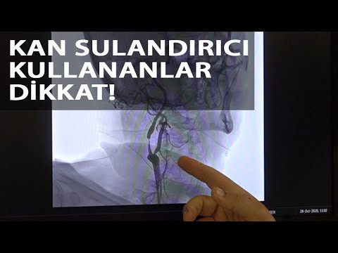 Prof. Dr. Zülfikar Arlıer: Kan sulandırıcı kullanan hastalarda…